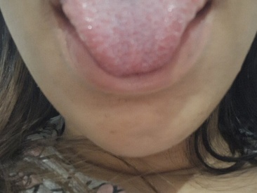 atrevidallf1