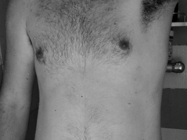 brunbarbu98