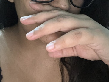 excuseddimple
