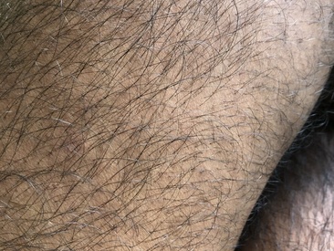 hairy-dick6