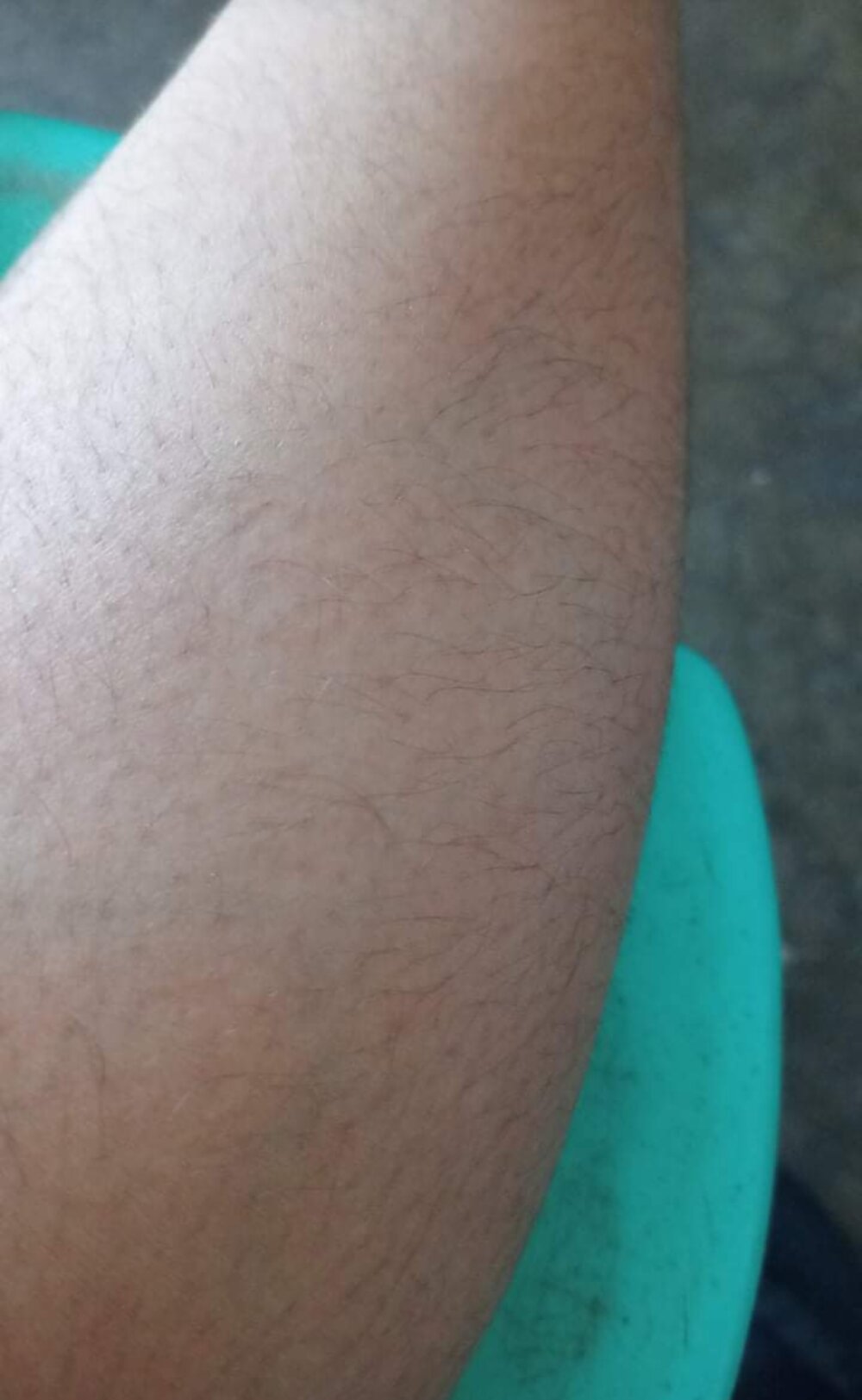 SkinnyTeeen Chatroom