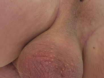 tn-cock