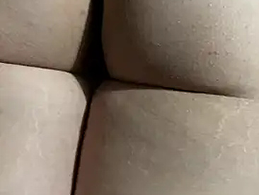 xx2564