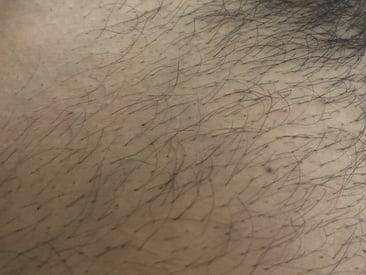 disporeelgrossebite