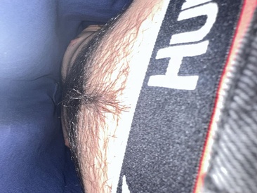 hairytwinkubus