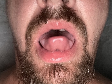 lickyoursall