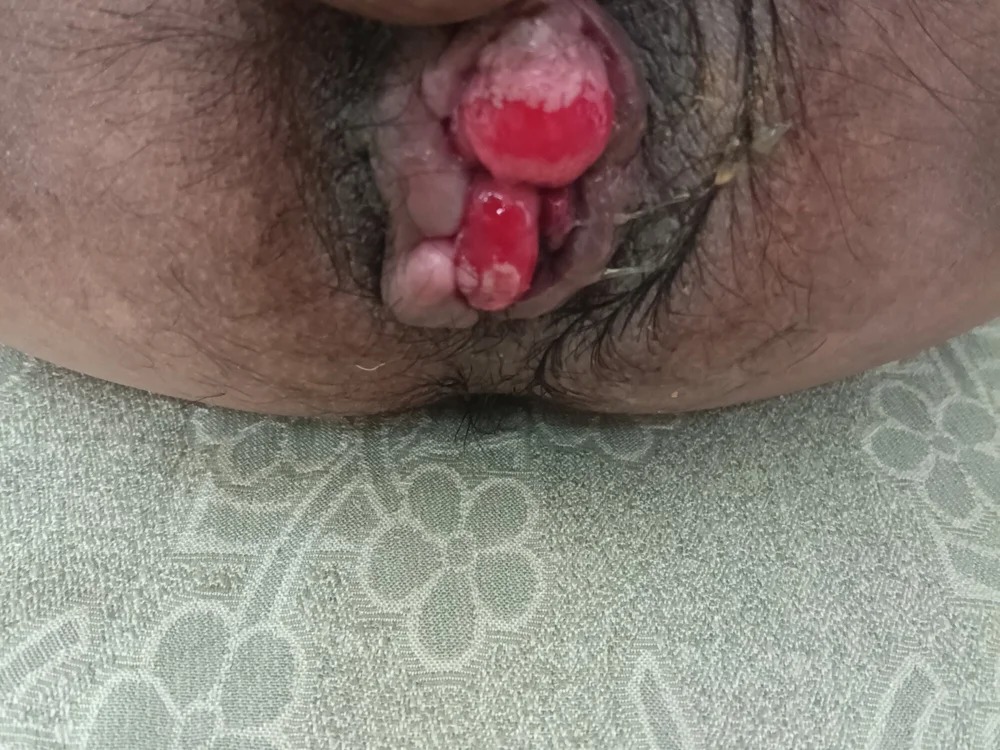 onlyfuckf Chatroom