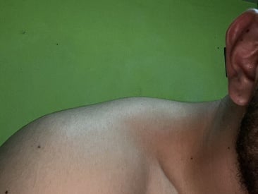 pollarosita10